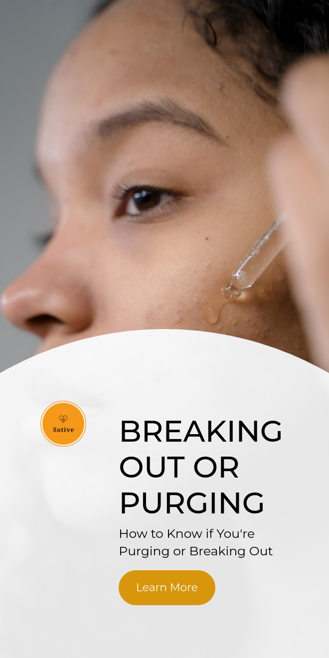 Breaking out or Purging